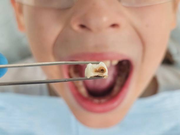 Dentist for Dental Trauma in MN